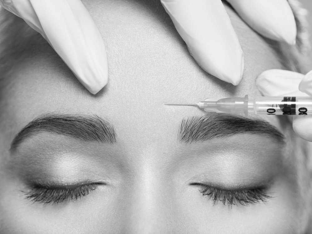 10 consejos antes de someterte a una miomodulación facial 2 botox frente