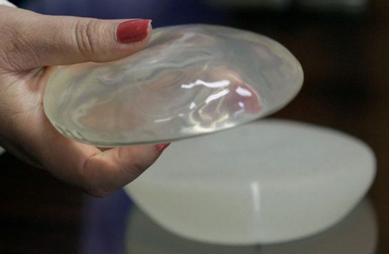 evolucion composicion implantes mama