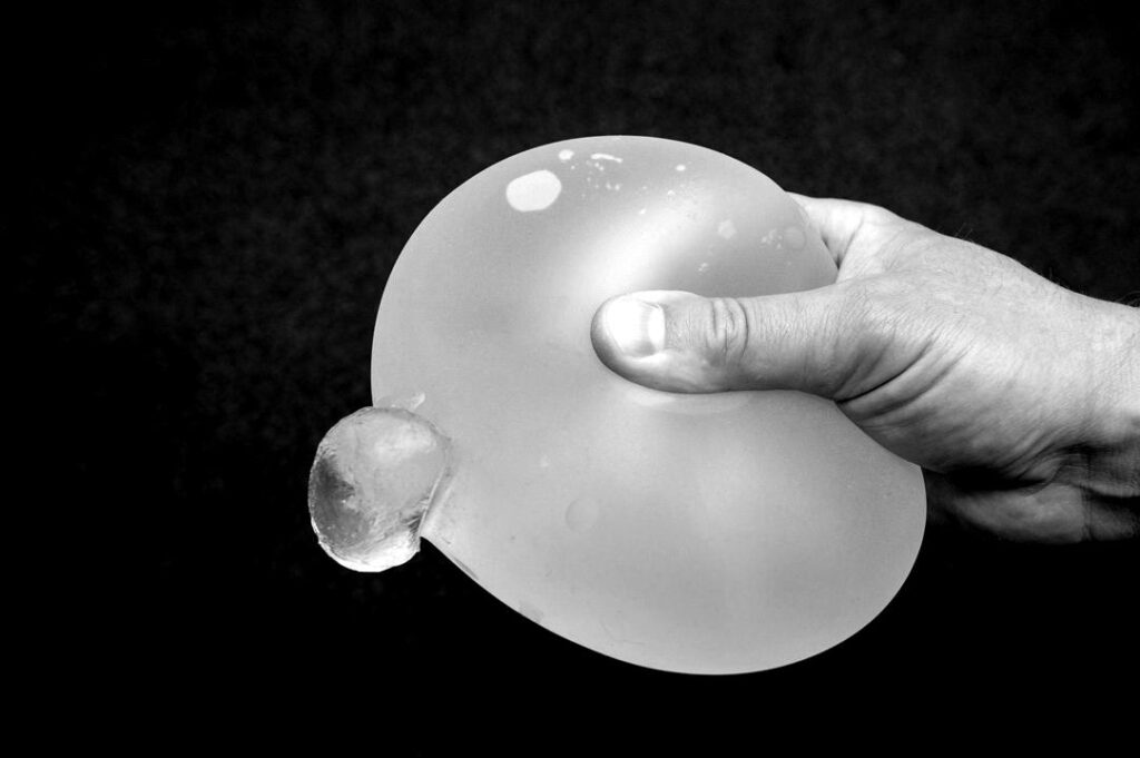 Tengo el implante mamario roto. ¿Qué hago? 1 protesis mama rota blackwhite