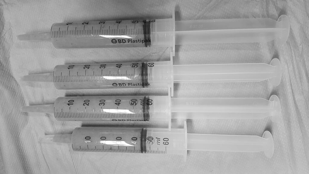 Lipofilling: ¿es viable la supervivencia del tejido adiposo? 1 injerto grasa