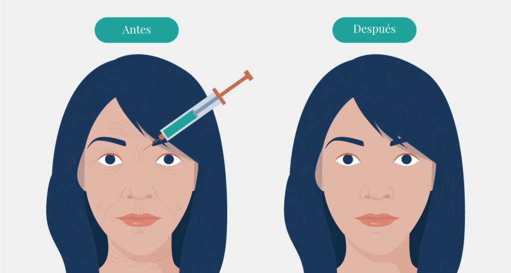 AGB Graficos Botox