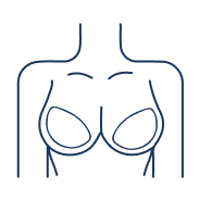 mamoplastia nb