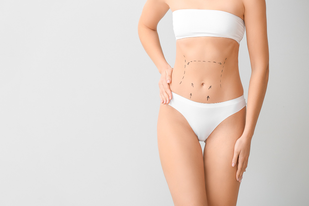 young woman with marks her belly against light background concept plastic surgery