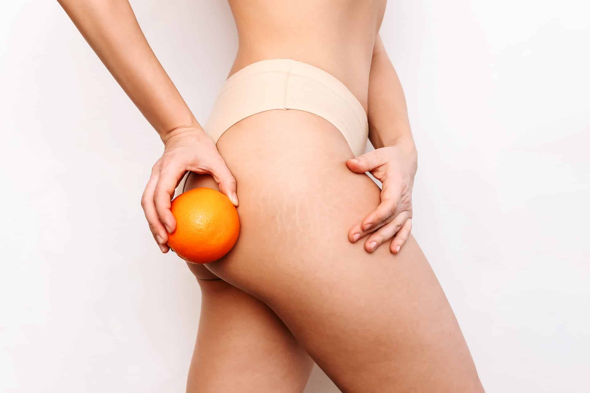anticelulitis