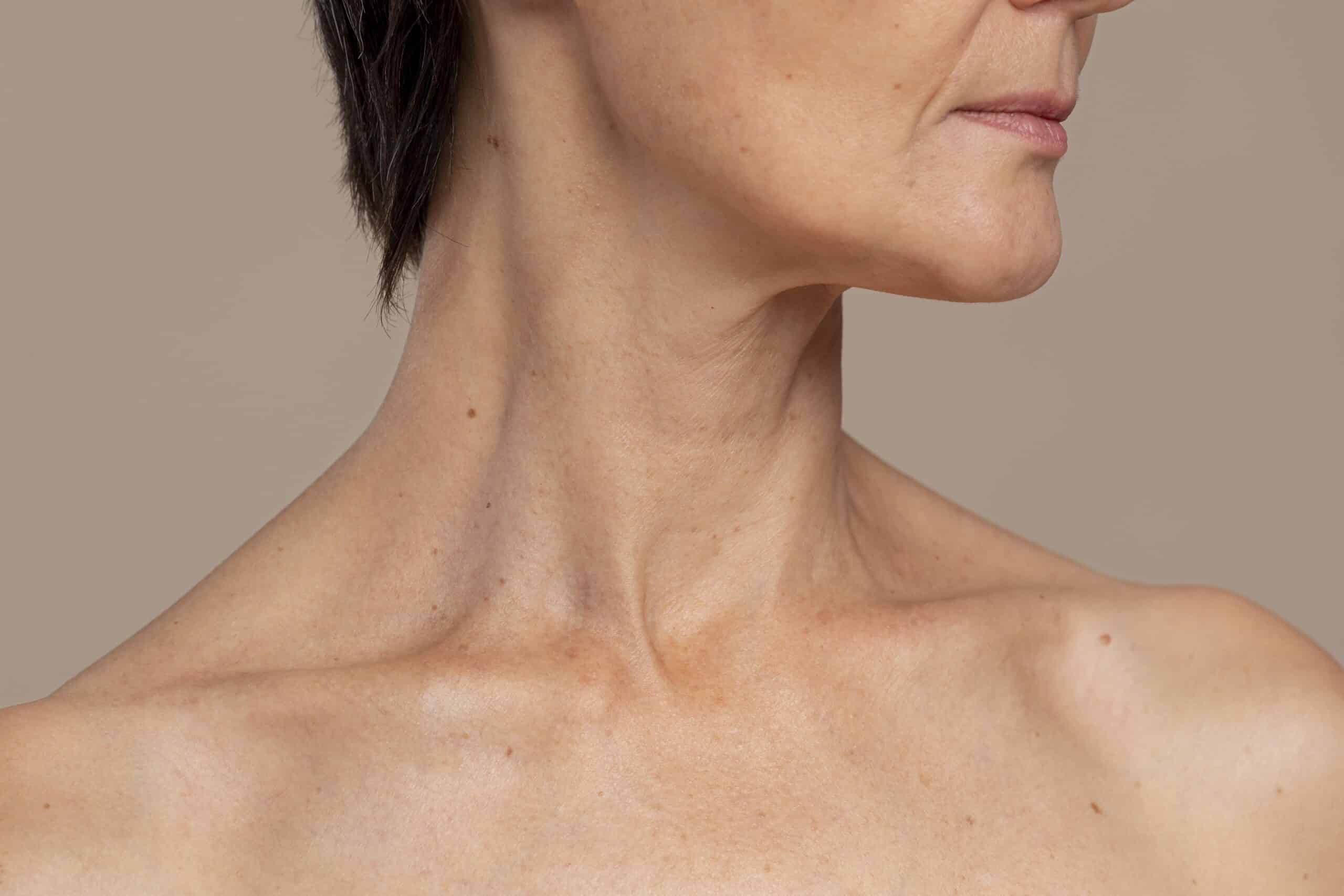cervicoplastia scaled 1