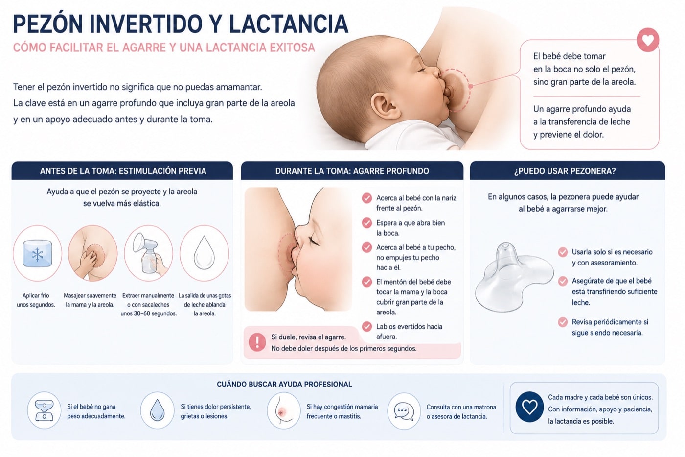 Lactancia con pezón invertido y agarre correcto del bebé